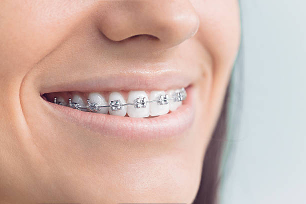 Dental Inlays and Onlays in Bristol, IN